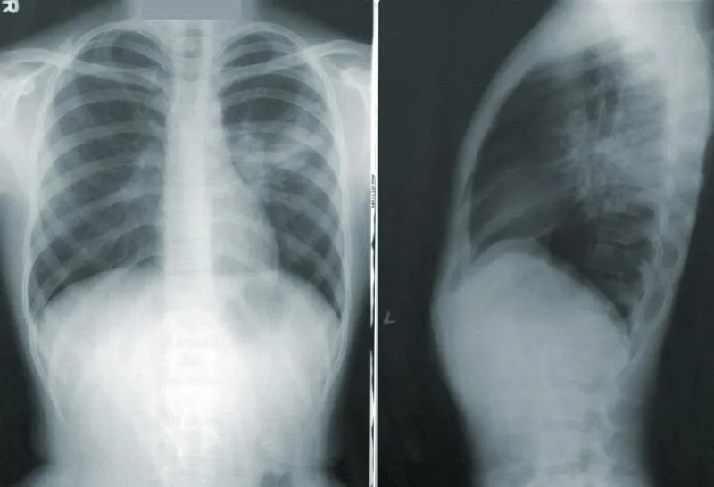 Teleradiologia - innowacja na rynku medycznym